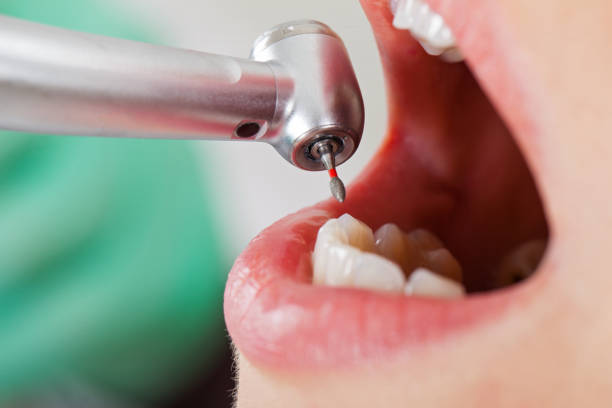 Best Cracked Tooth Emergency Dentist  in Morrisville, VT